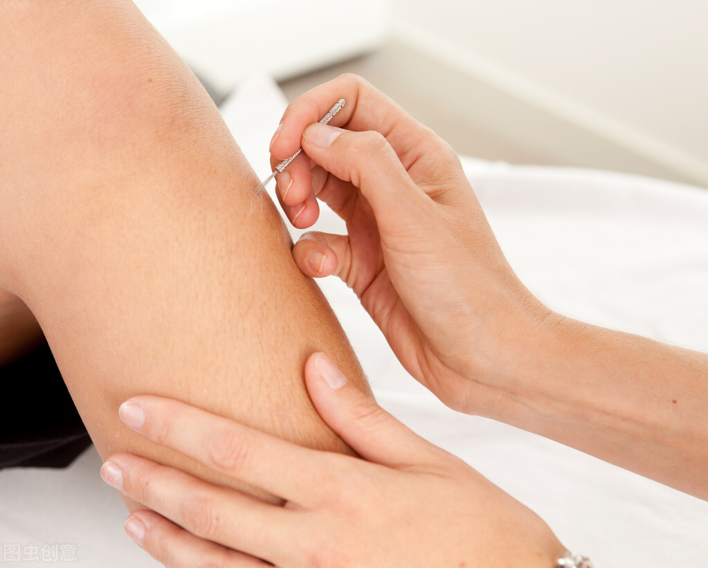 中风后遗症怎么治疗？试试针灸来调理，保守治理副作用小