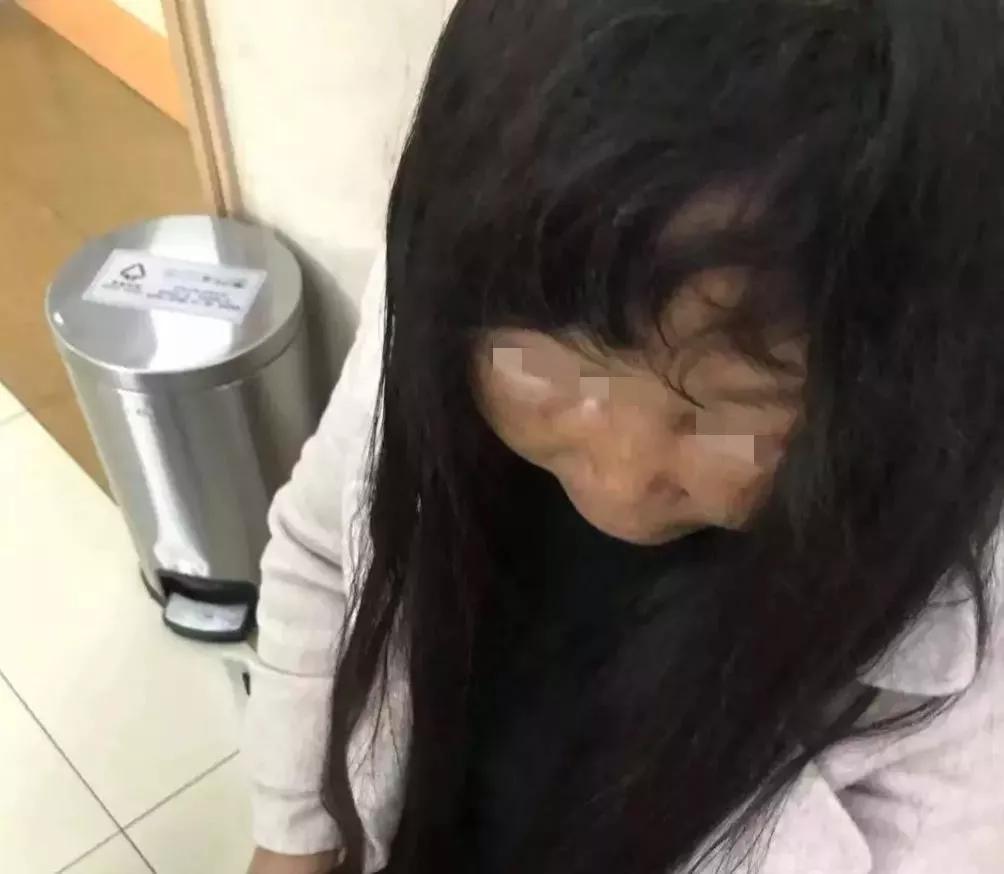 一夜之间,东阳女子瓜子脸变大饼脸!快过年了做这事要慎重