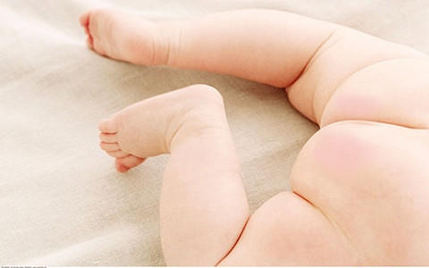 宝宝屁股沟红肿疼,屁股肛门有小肉球需要治疗吗