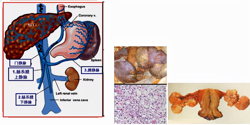 我不是药神,我不是财迷!若患胃癌,这些靶向药你有能力负担吗?