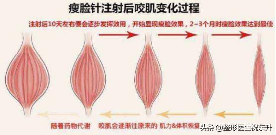 为什么打完瘦脸针脸会凹陷,刚刚打完瘦脸针一侧有鼓包怎么办