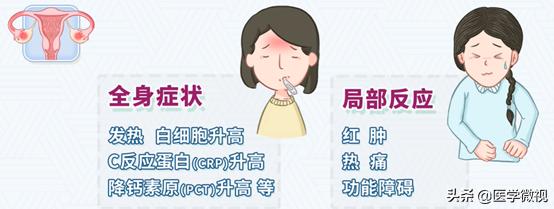 夫妻生活后，女性这种疾病患病率增加！请务必采取这2个健康措施