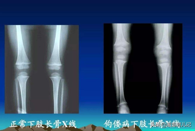 晚上盗汗衣服湿透什么原因,小儿睡觉盗汗啥原因怎么治