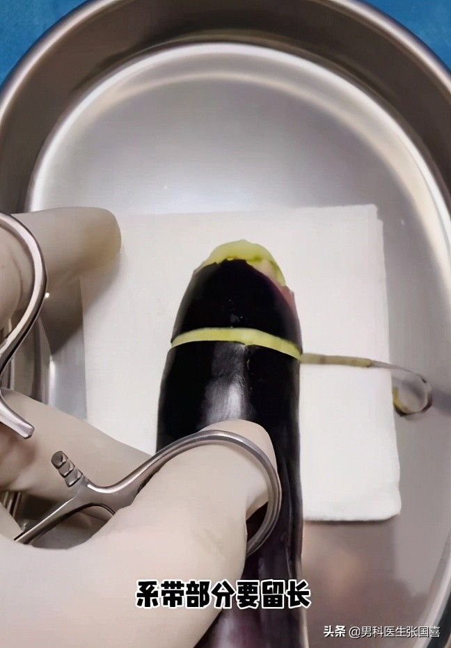 在中间剌一圈，居然还有这种割包皮的手术方法？