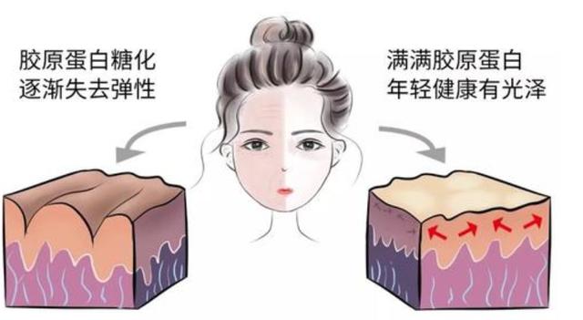 细纹干纹怎么消除,怎么知道自己皱纹是细纹还是干纹