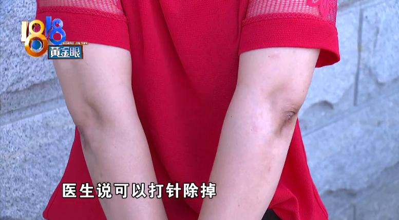 鑲樼毊鐐庢墦浜嗗嚑閽堝悗婧冪儌,鎵嬭倶鐨値娌荤枟