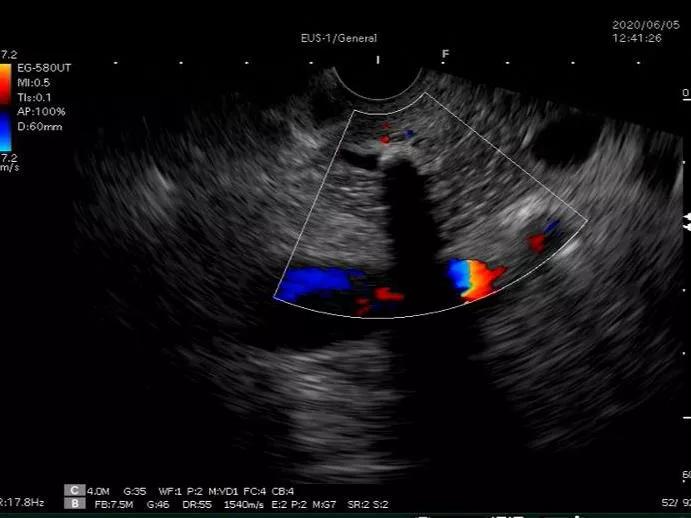 男子腹痛却找不出原因,男子腹痛难忍却查不出原因