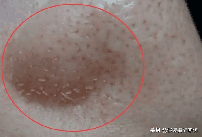 硫磺除螨止痒皂推荐,硫磺除螨皂排行第一名