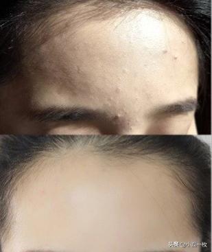 做医美真的可以变美,做什么医美可以让皮肤透亮