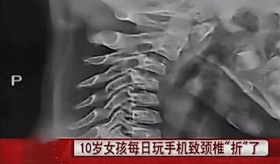 十一岁孩子视力和成人一样吗,11岁孩子视力不好能矫正吗