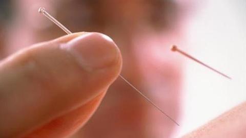 选择针灸,选针灸推拿学的理由