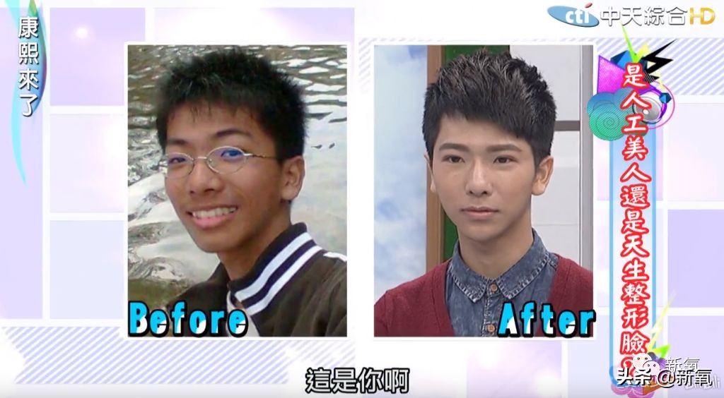 花90万从头整到脚,还可以这么自然?旁边纯天然小姐姐都看懵了