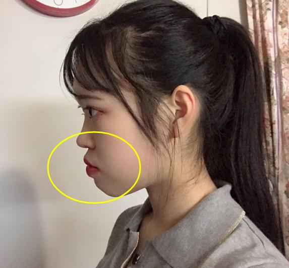 大鼻头凸嘴法令纹妆容教程,凸嘴厚嘴唇法令纹怎么化妆遮盖