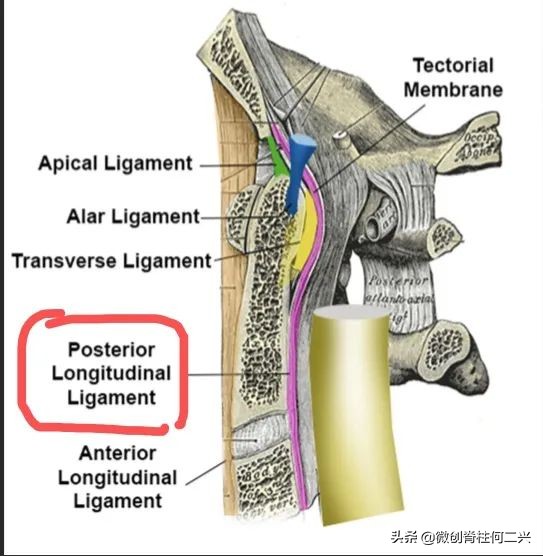 脊柱外科微创手术全过程,胸椎后纵韧带骨化症微创手术