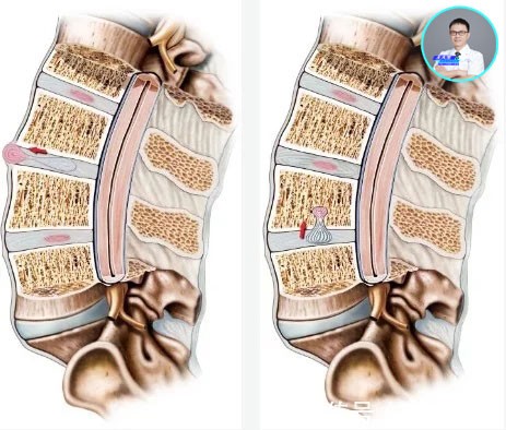 9岁女孩舞蹈练下腰瘫痪全部过程,孩子舞蹈训练下腰截瘫
