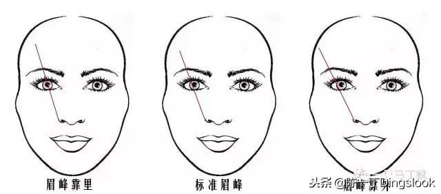颧骨高太阳穴凹陷怎么改善脸型,颧骨宽大太阳穴凹陷快速改善