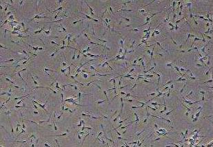 生产效率低原因及改善措施,生产效率提升不起来如何解决