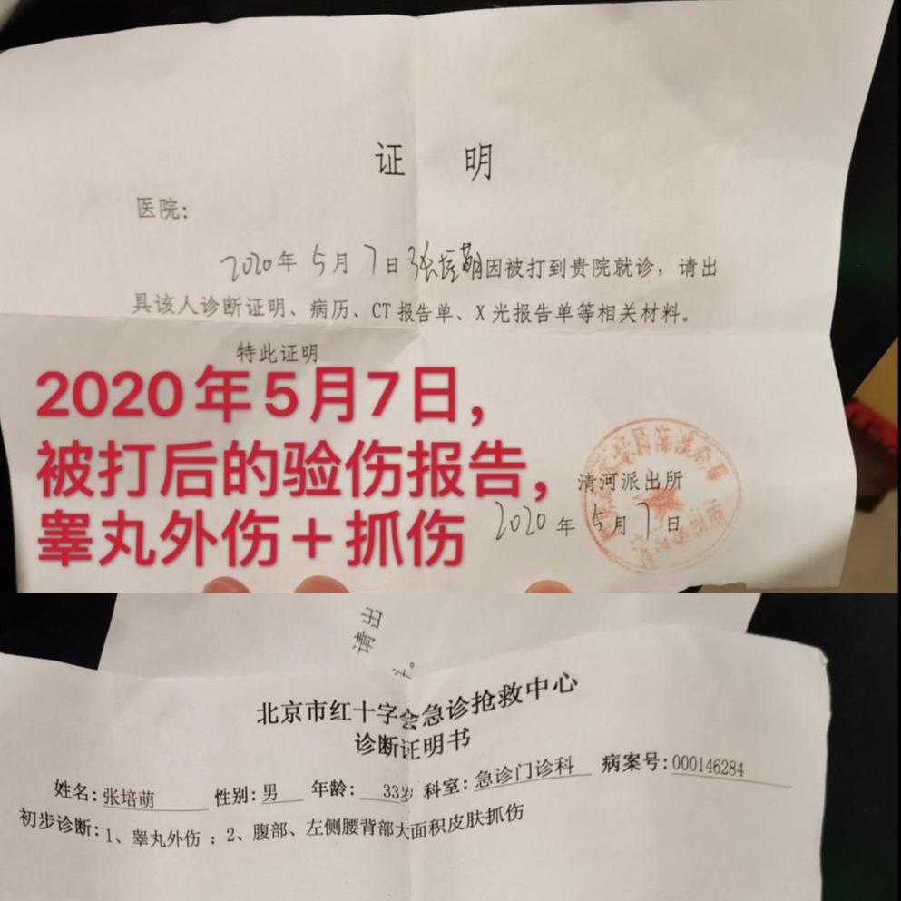 张培萌回复家暴视频,张培萌因殴打岳母被拘