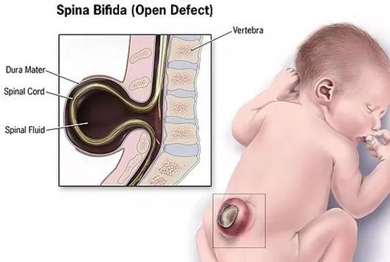 人造精子可以解决的问题,人造精子