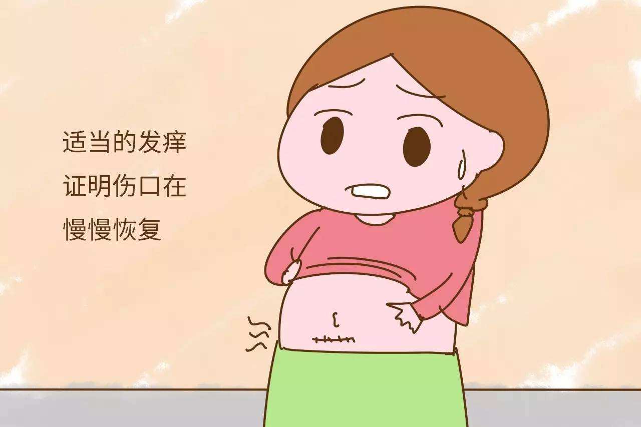 孕妇坐月子是否使用收腹带,孕妇产后需要绑束缚带吗