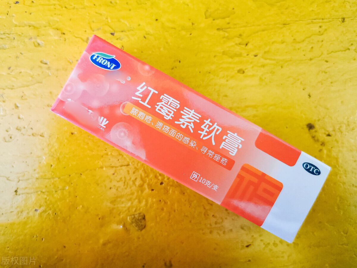 红霉素软膏放到家里有什么好处,红霉素软膏对于妇科的作用