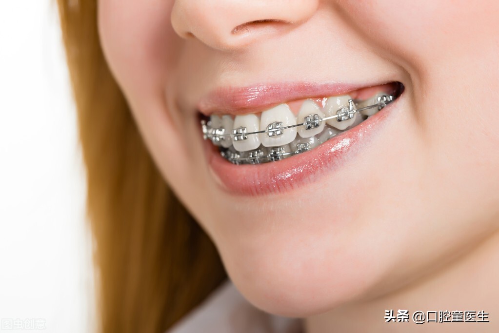 到底有没有必要整牙,为什么建议不要随便整牙