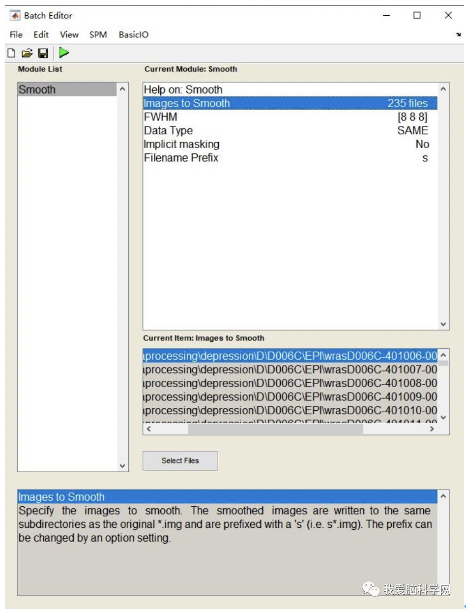 脑功能报告解读,颅脑mri信号讲解视频教程