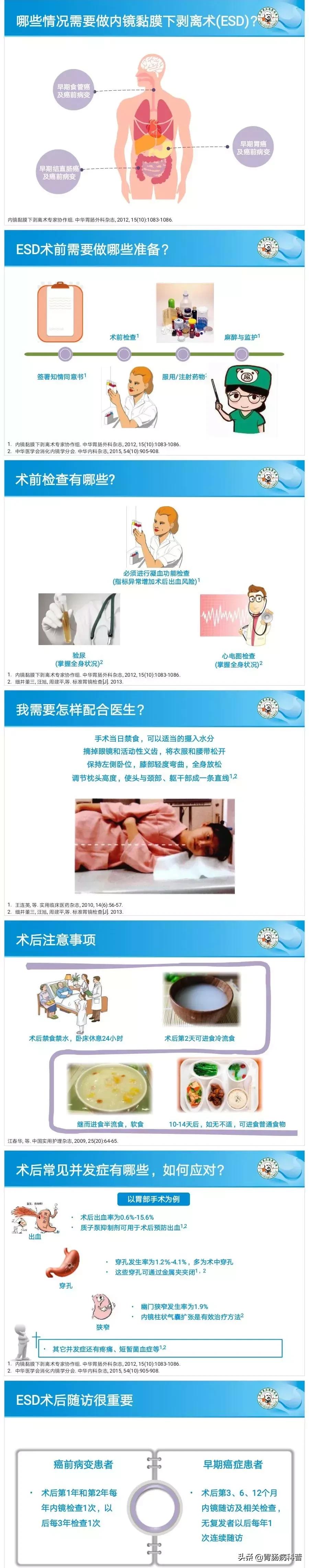 内镜下粘膜剥离术属于esd还是emr,胃肠息肉内镜下黏膜剥离术