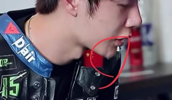 武汉协和医院王医生,武汉协和王医生