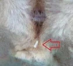 菊部周边长了个肉疙瘩,菊部旁边长了个肉疙瘩