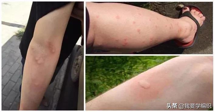 全网狂销10W+盒,日本“变态”驱蚊剂!网友:1盒搞定整个夏天