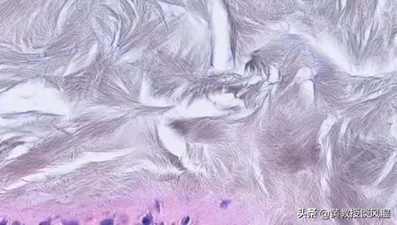 痛风的正确治疗方法,小鹅痛风的正确治疗方法