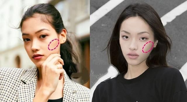 凸嘴的五官比例,宽眼距塌鼻梁凸嘴