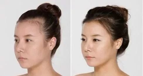 怎么去黑头最有效教你5个小妙招,怎么去黑头最有效最方便的方法