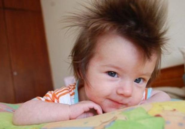 小孩头发像刺猬一样什么原因,小宝宝头发一绺一绺的是怎么回事