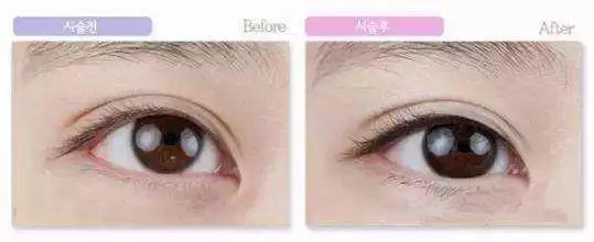 做半永久多少钱,做半永久眉毛后悔期