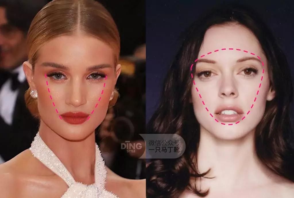 颧弓高脸型怎么改善,有泪沟可以通过调整脸型改善嘛