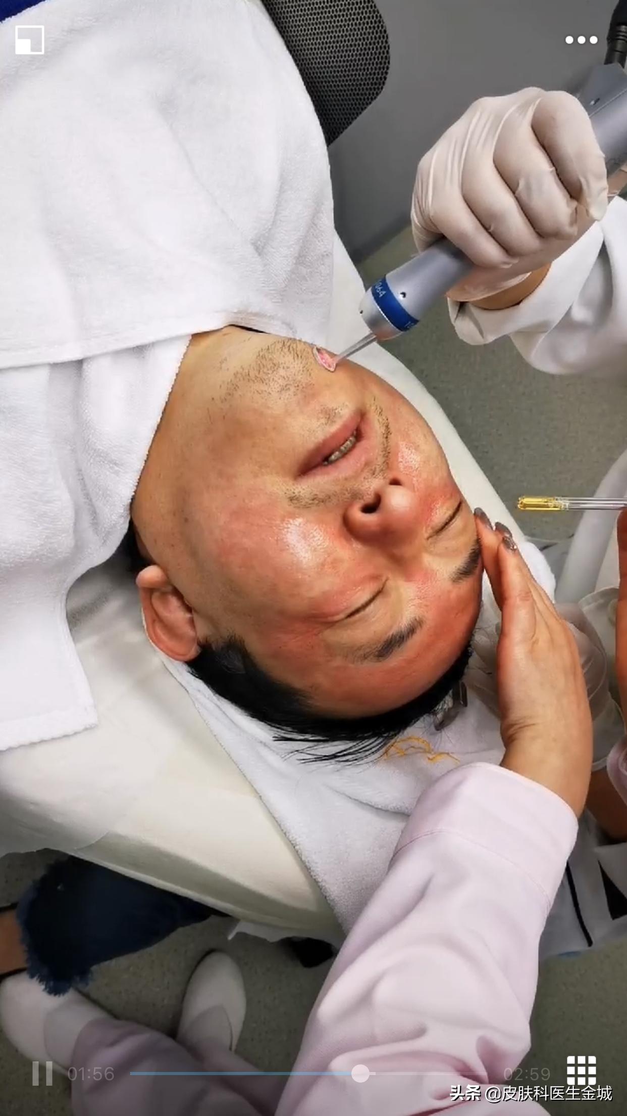 皮肤美容医生超皮秒全体验,皮肤美容医生超皮秒