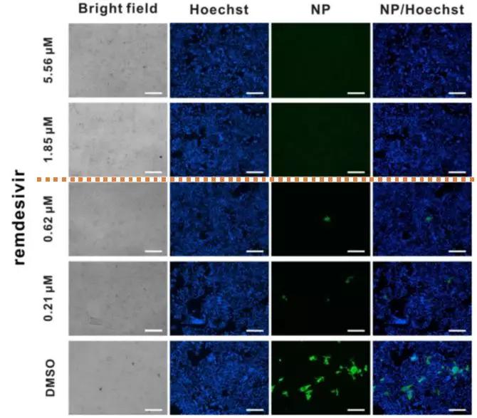 吉利德公司新型冠状病毒最新数据,吉利德新冠