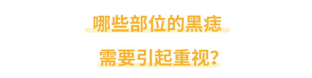 面积大的痣一定是黑色素瘤吗,恶性雀斑样痣与黑色素瘤
