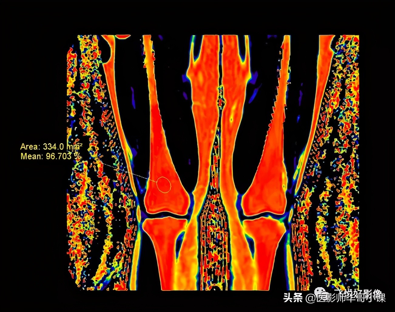 飞利浦磁共振快速扫描方案指南,飞利浦1.5t磁共振各部位扫描技术