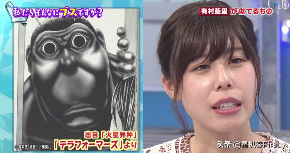 下颌骨缩小整容,下颌骨切除整容