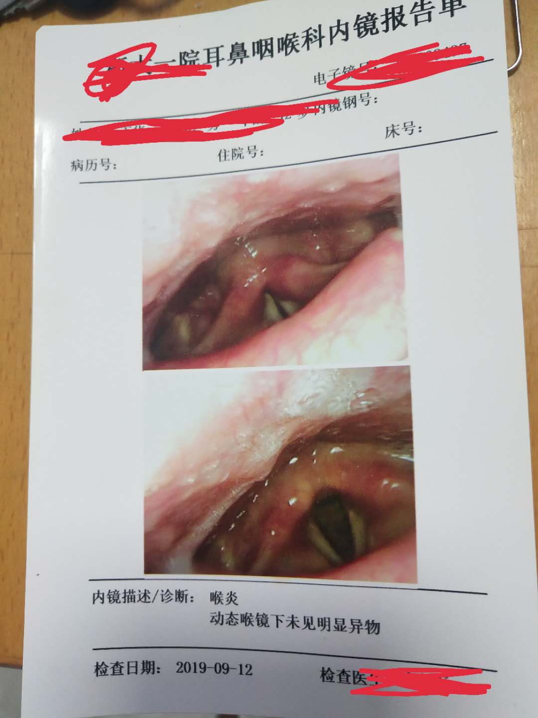 求助鱼刺卡喉偏方,续三