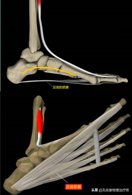 如何治疗足底筋膜炎缓解疼痛,足跟痛筋膜炎最佳的治疗办法