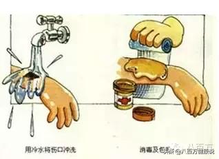 烫伤烧伤的紧急处理ppt,孩子被开水烫伤了该如何紧急处理