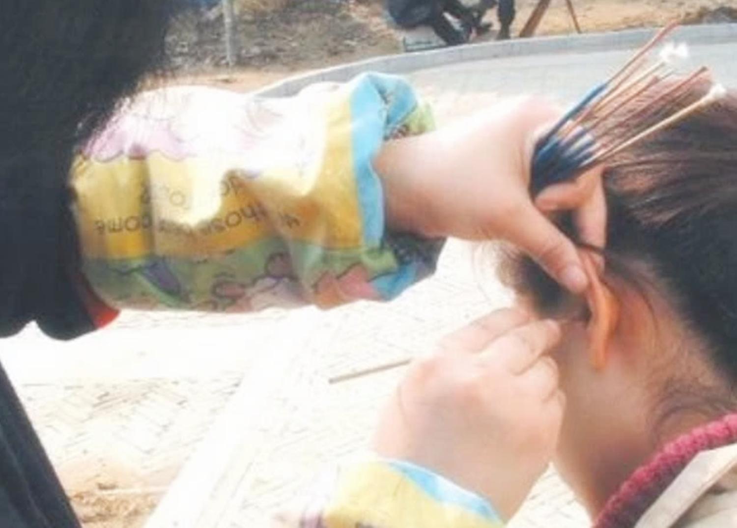 6岁女童耳朵疼取出虫子,小孩耳朵里钻进虫子