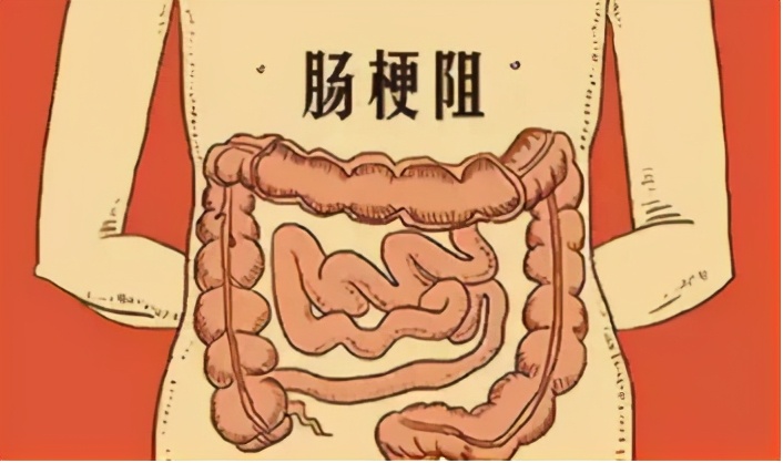 肠鸣闹肚子恶心,肠鸣频繁是什么原因引起的
