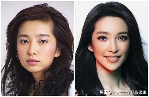 瘦脸针瘦腿针瘦肩针该怎么选,瘦肩针跟瘦脸针是不是一样的