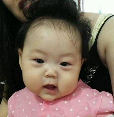 孩子脸上长斑是脾胃不好引起的吗,脾胃虚弱的宝宝身体都有什么症状