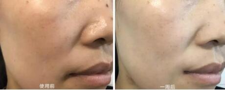 公认最好的平价国货面膜,用过最好用的国货面膜